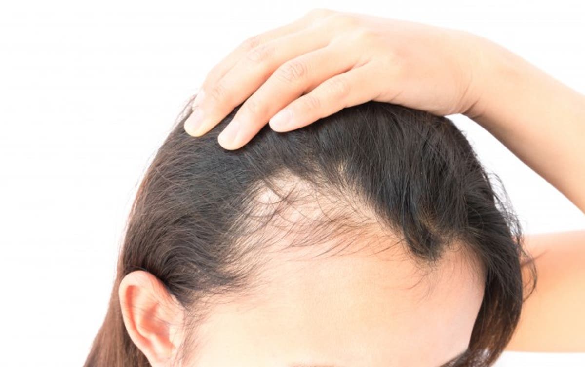 10 superalimentos que debes consumir si sufres pérdida de cabello - 7 - mayo 19, 2022