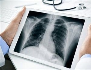 Costo escolar de rayos X/técnico de radiología - en 2022 - 9 - julio 21, 2022