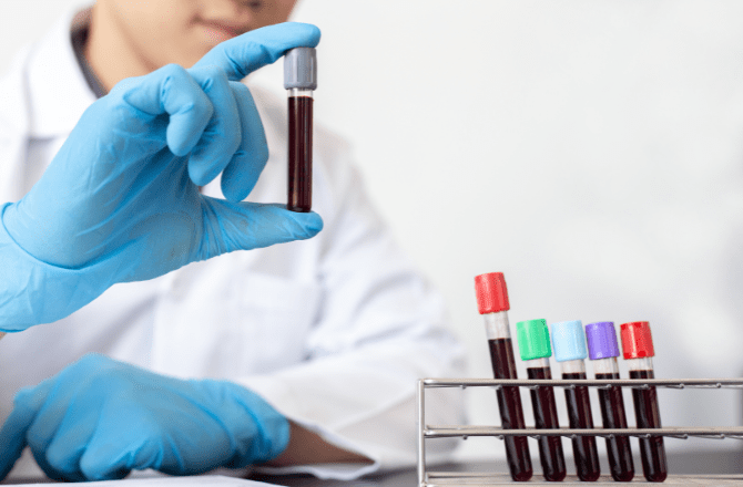¿Qué significa PDW bajo en el análisis de sangre? - 1 - enero 10, 2023