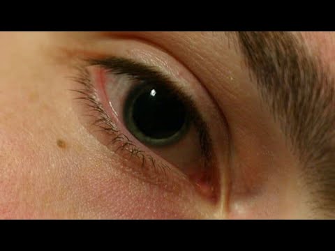 Pupilas dilatadas drogas - 3 - abril 11, 2022