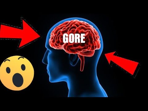 ¿Por qué se llama Gore? - 57 - enero 20, 2022