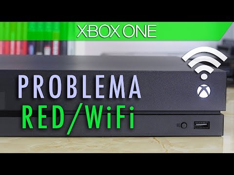 ¿Por qué mi Ethernet no funciona con Xbox? - 3 - noviembre 17, 2021