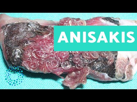Lista de pescados sin anisakis - 27 - mayo 6, 2022