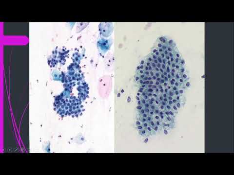 Celulas endocervicales presentes - 31 - mayo 6, 2022