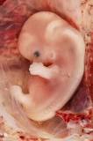 diferencia entre cigoto embrión y feto