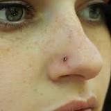 betadine piercing nariz