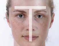 ¿Cuáles son los poros dilatados?