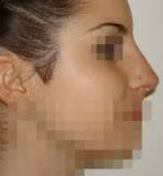 ¿Cómo se llaman las partes de la nariz?