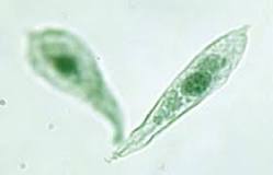 ¿Qué tipo de organismo es el alga?