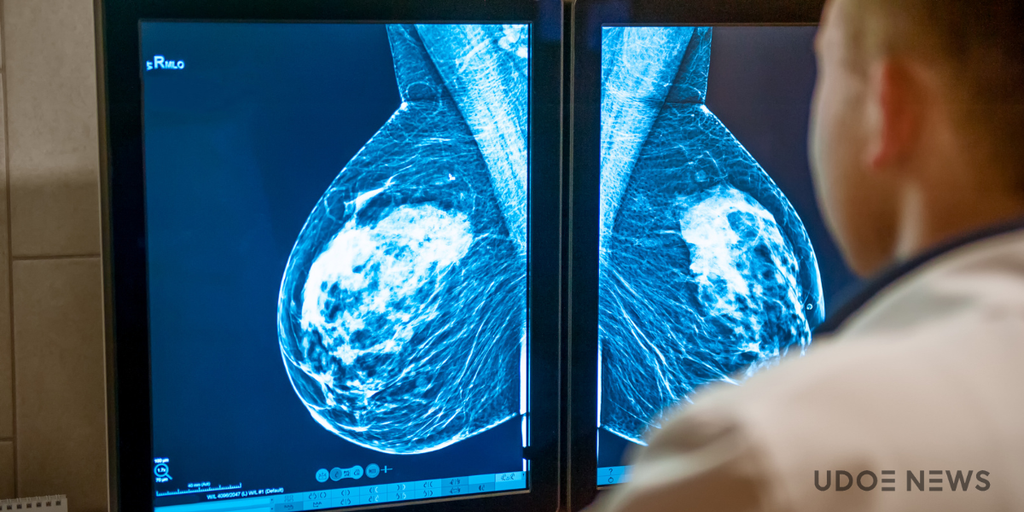 ¿Cuanto tardan en llamar si mamografía anormal? - 7 - febrero 28, 2023