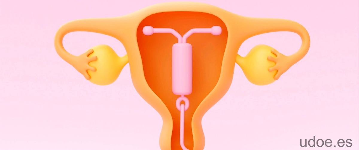 Utero globuloso: una afección común en mujeres - 13 - octubre 3, 2023